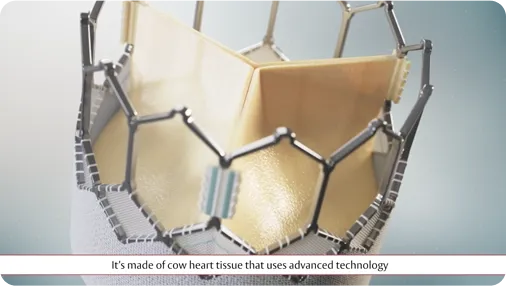 Video thumbnail: Why choose TAVR