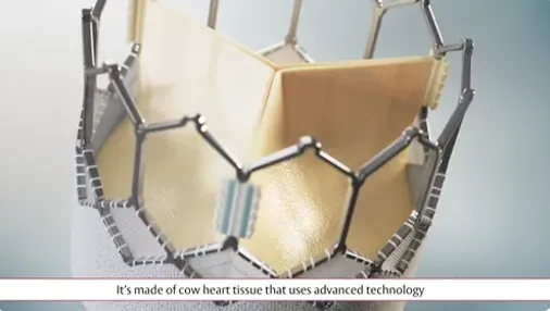 Video thumbnail: Why choose TAVR